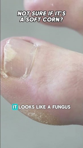 Pain between your toes?