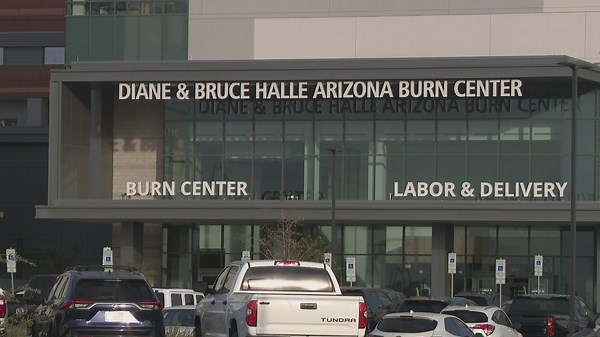 Arizona Burn Center director speaks about treating firework burn victims