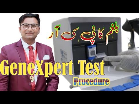 Cepheid GeneXpert | GeneXpert Test method step by Step | Sputum test
