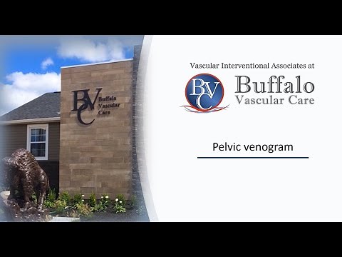 Procedure Instructions Venogram