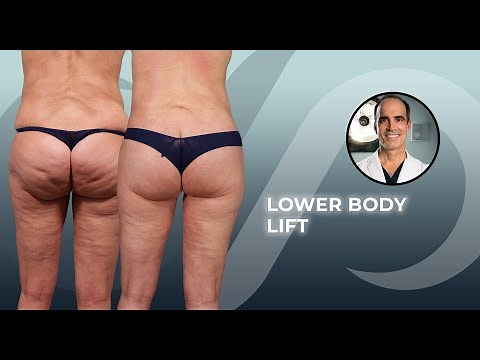 Before and After Lower Body Lift Surgery: Transform Your Figure
