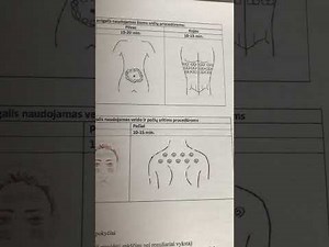 Cavitation and rf device LW-101