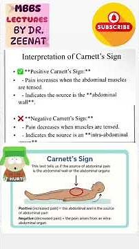 Carnett’s Sign | Abdominal Wall Pain vs Intra-Abdominal Pain
