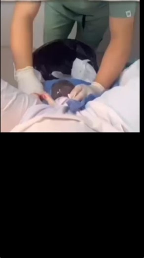 7.3K views · 38 reactions | Beautiful Breech c section delivery ♥️#chandututorialeducation #viral #pregnancy | Chandan Kumar Chandu | Facebook