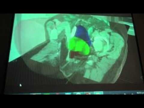 UNI: Biomedical Engineering, a new degree program at UNI