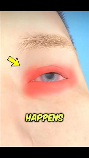 Your Body’s Warning Signs You Should Never Ignore (Pink Eye) #viral