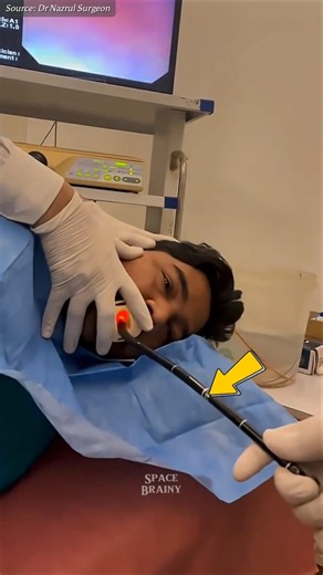 Robotic Capsule Replace Endoscopy Treatment😲 #shorts