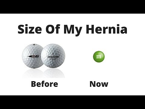 How I Got My Inguinal Hernia To Be Almost Completely Healed