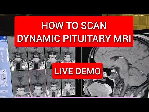 Pituitary Gland Dynamic MRI scan Protocol, Positioning & Planning.