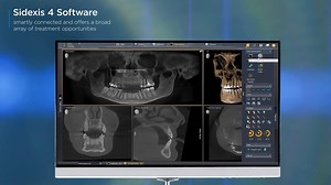All Images and X-rays in one Platform - Sidexis 4. This award-winning software offers a modern user interface supporting a clear diagnosis, workflow efficiency, smart connectivity and simple patient communication. It starts here. Find out more: www.dentsplysirona.com/axeos #axeos #imaging #sidexis4 #smartconnectivity #3dimaging #conebeam #implantology #radiology #sidexis4 | Dentsply Sirona