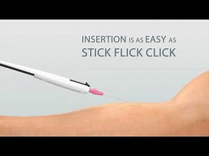 Stiletto Extended Dwell Catheter Animated Process by Slipstream Medical