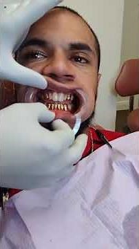 Giving this patient 8 GOLD TEETH