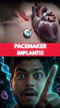 Doctors Secret Pacemaker Implant Technique Revealed