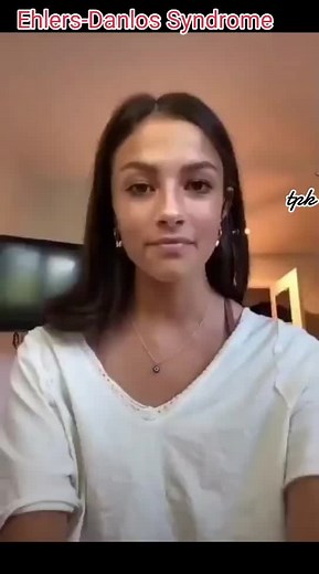 Understanding Ehlers-Danlos Syndrome: Connective Tissue Disorders Explained