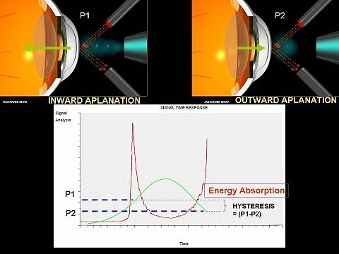 How does ocular response analyser works
