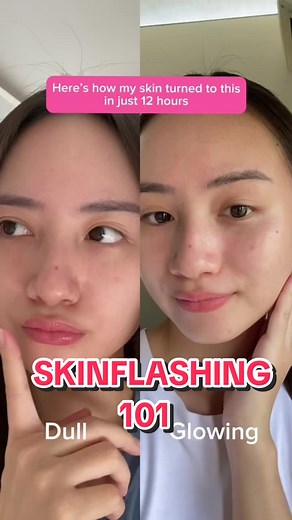 Skin Flashing 101: Glowing Skin Transformation in 12 Hours