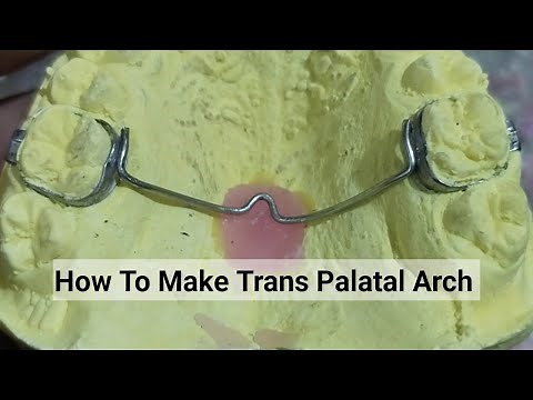 How to Make Transpalatal Arch || TPA orthodontic Appliance By Haider...