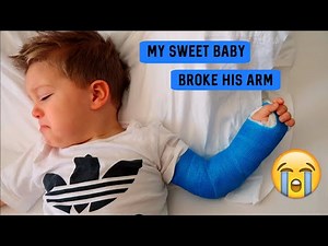 Toddler BREAKS Arm In TWO Places | Got His Cast On | Vlog 7 | Hannah Michelle