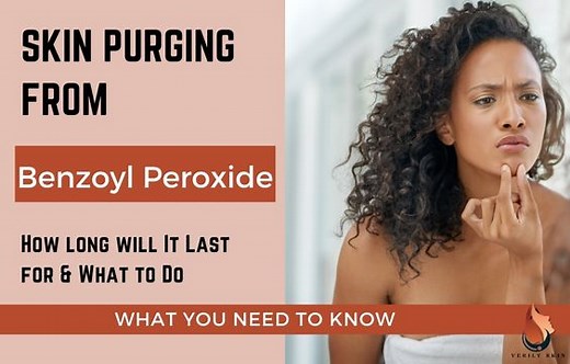 Benzoyl Peroxide Skin Purge - Everything You Need To Know  - Sasily Skin