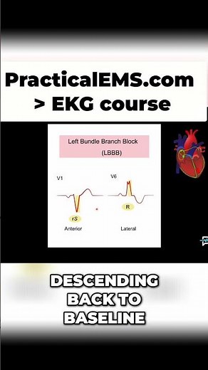 EKG Waveforms: V1 vs V6 - Know the Difference Instantly! #shorts