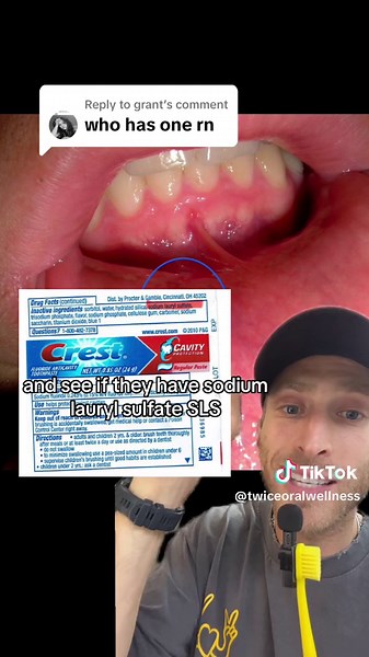 Replying to @grant #greenscreen so painful, time to switch your toothpaste to Twice! Our SLS-free toothpaste is available at Walmart 🦷🪥🫶🏼 #cankersore #oralwellness #twicetoothpaste #teeth #dentist #walmart