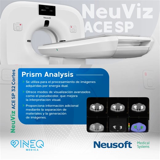 🌟 Innovación en procesamiento de imágenes con el NeuViz ACE SP de Neusoft Medical Systems 🌟 El Prism Analysis utiliza tecnología de energía dual para ofrecer imágenes más detalladas y precisas. Con modos avanzados de visualización, como el pseudocolor, facilita la interpretación de datos complejos y proporciona información adicional a través de la separación de materiales, mejorando la precisión diagnóstica. 📲 CONTÁCTANOS: 📩 WhatsApp: 504 9937-8656 📧 Correo electrónico: info@ineqmedica.net 