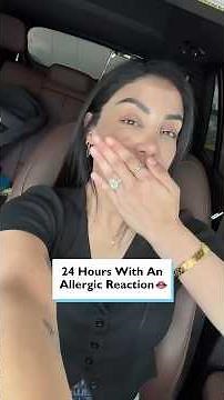 My face swelled up after this... 😱 #lipfiller #dissolvingfiller #allergicreaction #beautyfail