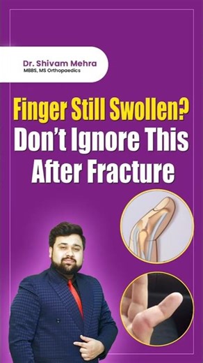 Why Your Finger Is Not Healing After Fracture 🚨 Signs You Shouldn’t Ignore