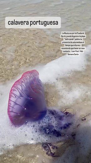 “Calavera portuguesa” #Medusa Autoridades venezolanas se mantienen alertas durante el asueto de semana santa, debido a la presencia de las medusas «calavera portuguesa» en playas de Aragua, Carabobo y Falcón. Estas medusas poseen colores entre violeta y rosado transparente, tienen extensos tentáculos que al contacto con la piel generan serios daños en la salud. El veneno de las medusas, la thalassina es una de las toxinas más comunes y se encuentra en muchísimas de las picaduras. En baja dosis, 