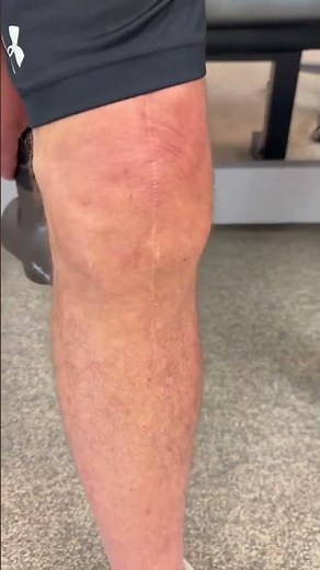 Warming up the calf and hamstring with the Bob and Brad Massage gun after a total knee replacement s
