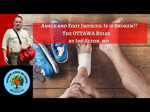 Ankle and Foot Injuries: OTTAWA Rules Explained to Check for Fractures