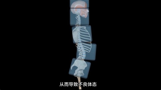 教练总说不要代偿，但什么是代偿