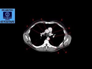 PART2 - CT THORAX NORMAL ANATOMY