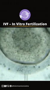 392K views · 3.4K reactions | In vitro fertilization (ivf) is a treatment to help people have a baby. eggs are taken from a woman’s body, mixed with sperm in a lab, and then placed back into the uterus. It’s often used when other ways to get pregnant don’t work.for educational purpose only. #ivf #fertilitytreatment #infertilitysupport #babyhope #medicalscience #doctorpreneur #mbbsnotes #medstudentsa #reproductivehealth #educationonly | Dr Pranav Sharma | Facebook
