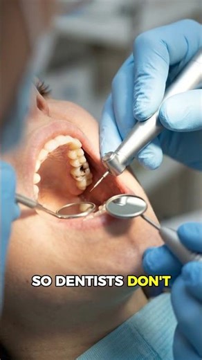 👉 Cavity removal dentist procedure explained