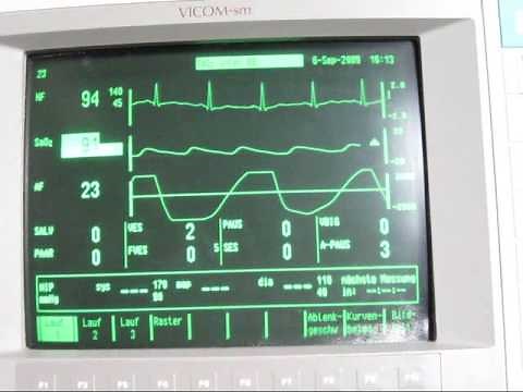 breath hold EKG with oxygen desaturation