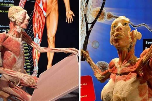 Fascinante exposición en Guatemala muestra órganos y cuerpos reales preservados