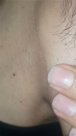 Beard Hair Massage therapy Satisfying ASMR Shorts #asmr #beard #massage #satisfying #ingrownhair