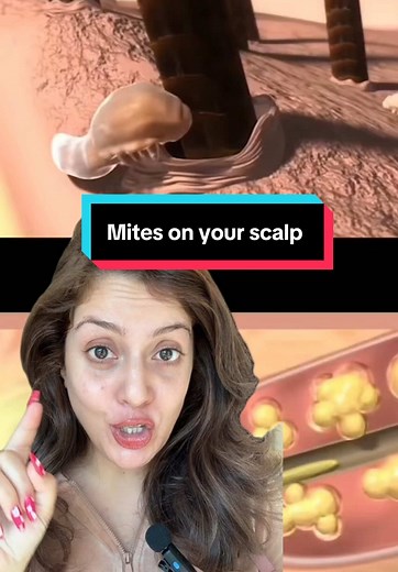 Understanding Demodex Mites and Scalp Health