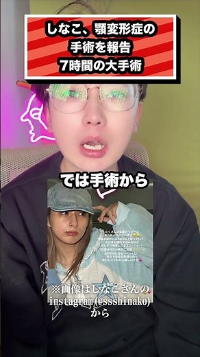しなこ、顎変形症の 手術を報告 7時間の大手術 #しなこ#ベビタピ#原宿パラダイス#ユーチューバー