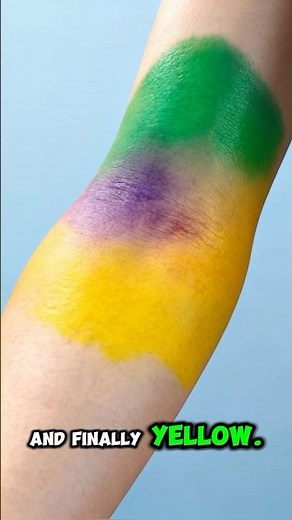 What Really Happens Under Your Skin When You Get a Bruise