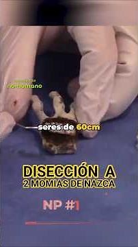 "Implants, bones, and an interesting response #NazcaMummies #Extraterrestrial #Fepo #Fermex