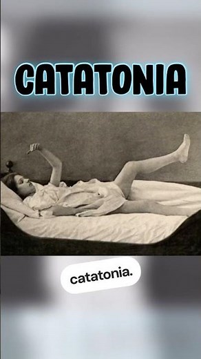 Waxy flexibility in catatonia #usmle #neetpg