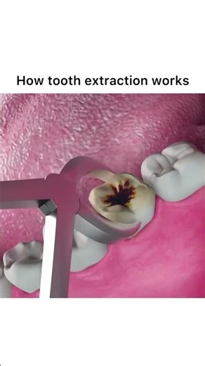 teeth Music from YouTube Audio Library (No Copyright)