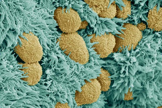 Choroid Plexus and Cerebrospinal Fluid in the Brain