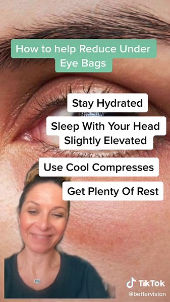 Reduce Under Eye Swelling: Tips and Remedies for Swollen Eyes