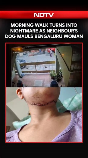A disturbing video has emerged showing a woman being attacked by a pet dog in a residential area in Bengaluru. The incident took place on January 26 at approximately 6:54 am in HSR Layout's Teachers' Colony while the woman was out for a morning walk. The dog reportedly attacked without provocation, biting her on the neck. When a man rushed to her rescue, the dog turned on him as well. Footage shows the man grabbing the dog by the neck to pull it away from the victim. While the man struggled with