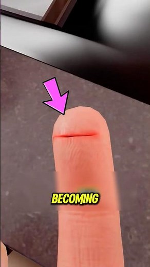 Why paper cuts are secretly the worst #pain #facts #shorts