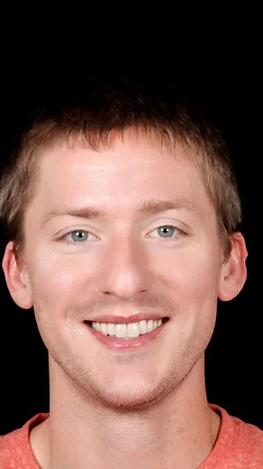 Just a few faces that have come by 👋🏼 Beautiful smiles, beautiful patients, beautiful results ✨ | International Smiles