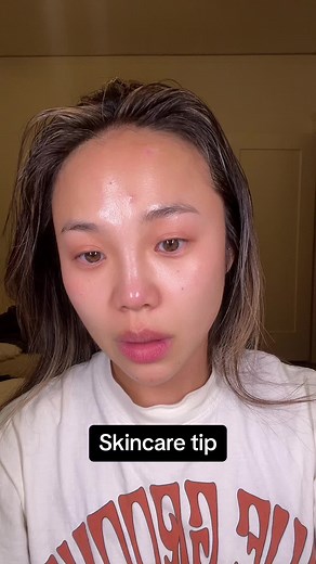 Skincare tip: never cover up acne or scabs with makeup. Let it heal properly and quickly so it does not scar. These bandaids are incredible 🫶 #kbeauty #skincaretips